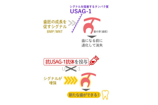 トレジェムバイオファーマ